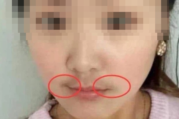 3 dấu hiệu quanh miệng cho thấy nữ giới đang mắc bệnh phụ khoa, nếu không có cái nào nghĩa là cơ thể bạn đang rất khỏe mạnh-2