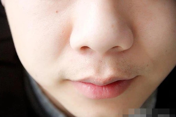 3 dấu hiệu quanh miệng cho thấy nữ giới đang mắc bệnh phụ khoa, nếu không có cái nào nghĩa là cơ thể bạn đang rất khỏe mạnh-3