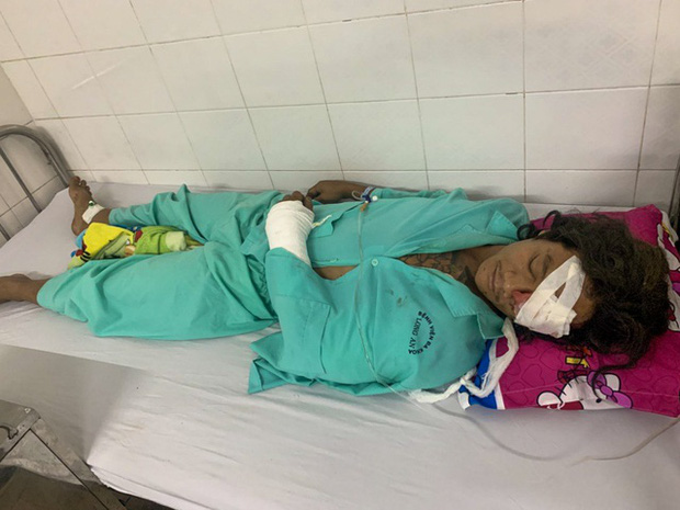 Vụ chó Pitbull nặng gần 60kg cắn chết người: Chủ nuôi từng đi cai nghiện hơn 10 lần, vẫn chưa xác định được danh tính nạn nhân-2