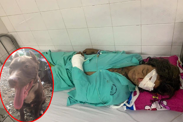 Bé trai dũng cảm giằng co cứu em gái thoát khỏi miệng chó dữ-1