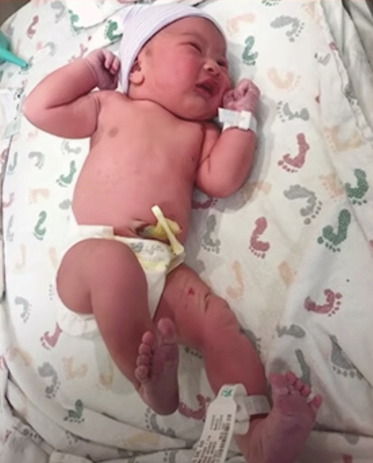 Sản phụ rặn đẻ 7 tiếng mà con không ra được, sinh xong bác sĩ phải gọi liên tục vì sợ bị hôn mê luôn trong lúc ngủ-7