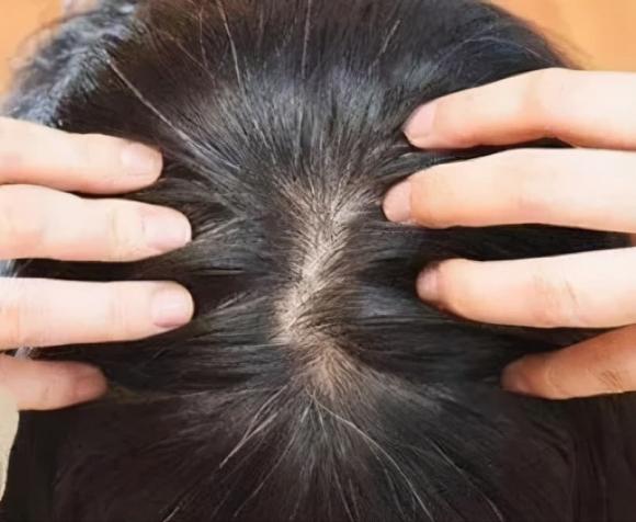 Với dầu gội này, tóc có bạc trắng bao nhiêu năm cũng trở nên đen như mực trong 5 phút-1