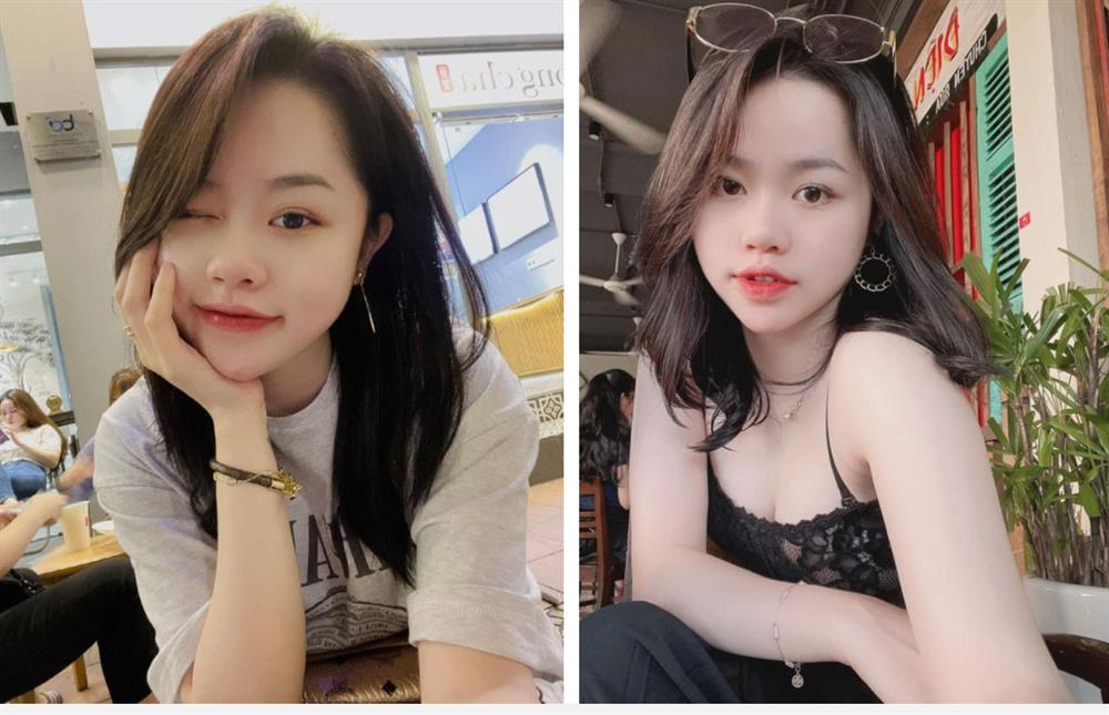 Bồ cũ Quang Hải công khai ảnh da đầy mụn trước đây, netizen sửng sốt vì thay đổi ngỡ ngàng-4