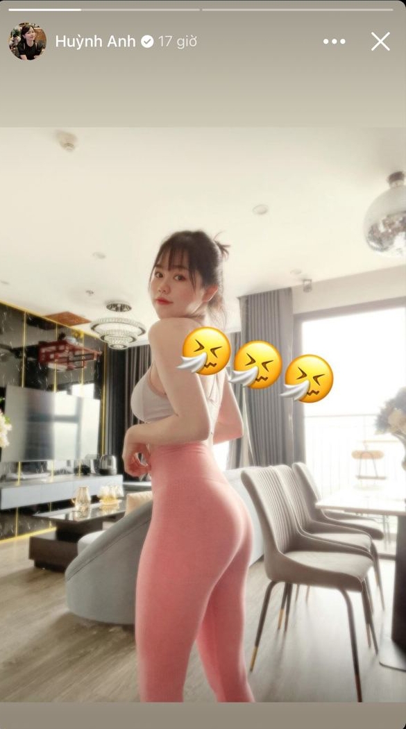 Bồ cũ Quang Hải công khai ảnh da đầy mụn trước đây, netizen sửng sốt vì thay đổi ngỡ ngàng-3