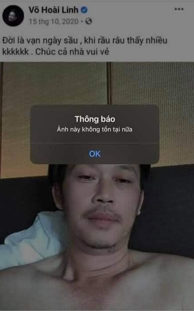 Netizen soi loạt chi tiết nghi vấn NS Hoài Linh không có vết sẹo mổ u tuyến giáp, xóa cả ảnh vì sơ hở, thực hư ra sao?-2