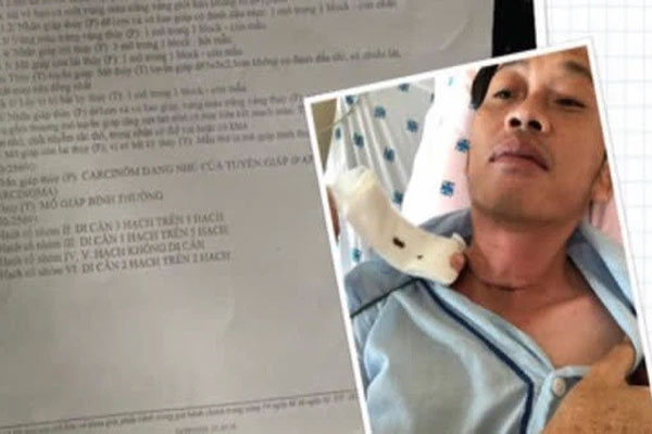 Bác sĩ: Hoài Linh bắt đầu xạ trị vào tháng 10, khả năng là phẫu thuật từ tháng 9 vì mổ xong sau 3-4 tuần mới bắt đầu điều trị-3