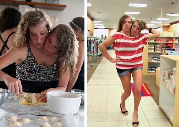 Cặp sinh đôi dính liền nổi tiếng với cơ thể chung nhưng vẫn có cuộc đời, tính cách và cả công việc khác biệt hoàn toàn khiến thế giới kinh ngạc-3