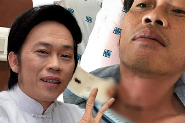 Hứa Minh Đạt đăng ảnh bảo vệ Hoài Linh giữa lùm xùm kèm triết lý: Khi bạn cho ai khác thứ gì, họ nghĩ đó là bổn phận-4