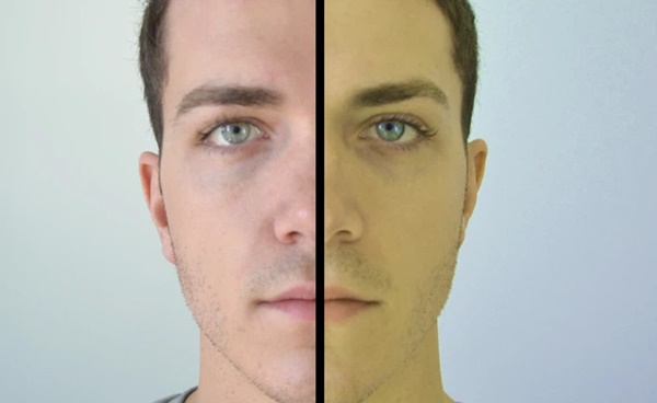 3 bộ phận này chuyển sang màu đen nghĩa là tế bào ung thư đang phát triển trong cơ thể-4