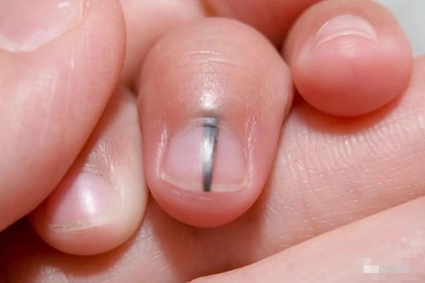 Thời điểm nguy hiểm nhất trong ngày bạn không nên dùng điện thoại vì có thể làm hỏng võng mạc, gây trầm cảm và ung thư-4