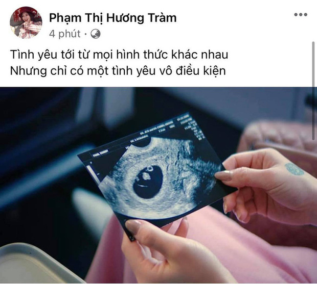 Bạn thân cuối cùng cũng hé lộ thực hư việc Hương Tràm mang thai sau hơn 2 năm sang Mỹ du học?-2