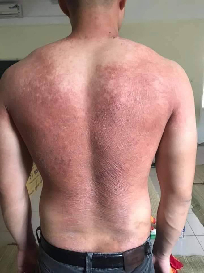 Bác sĩ mặc áo bảo hộ khoe vũ đạo vui nhộn: Sự lạc quan, yêu đời xua tan vất vả, mệt mỏi giữa tâm dịch Bắc Giang-5