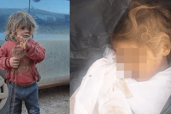 Cái chết của bé gái 6 tuổi bị xích, nhốt trong lồng gây chấn động thế giới và câu chuyện phía sau bức ảnh cuối đời lột trần thảm cảnh ít ai thấu