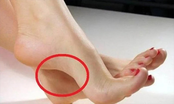 Dù nam hay nữ nếu có tướng bàn chân này: Thần Phật che chở, 3 đời tiêu không hết của-1