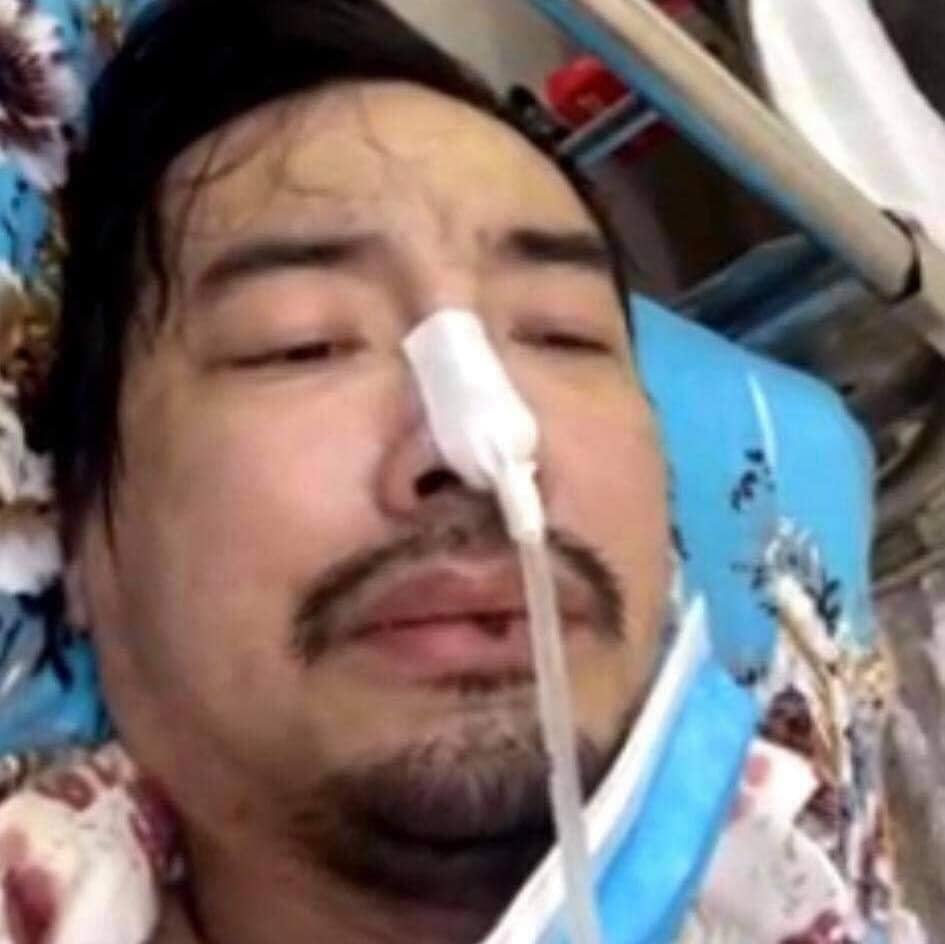 Ca sĩ Việt Quang bị viêm phổi nặng, đang trong tình trạng nguy kịch-1