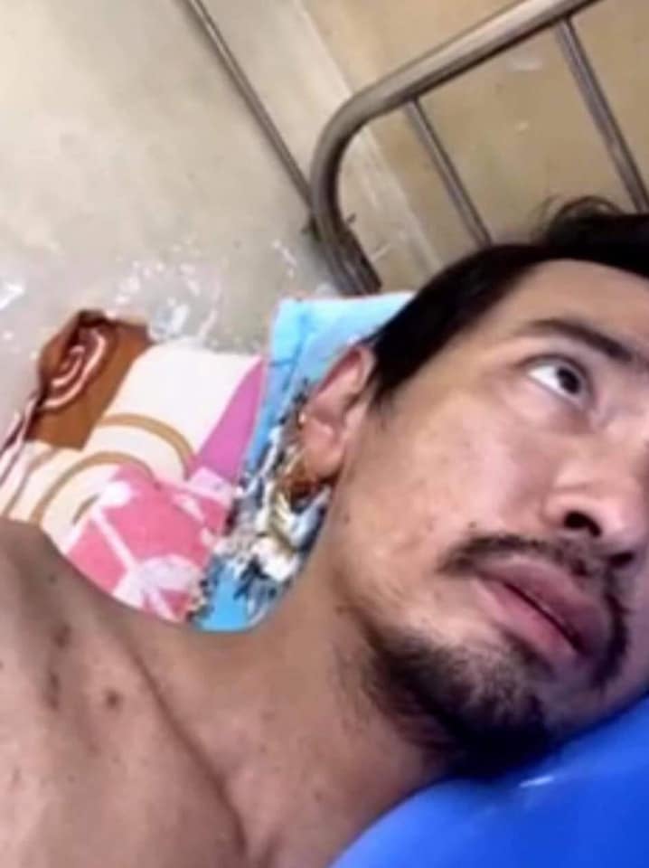 Ca sĩ Việt Quang bị viêm phổi nặng, đang trong tình trạng nguy kịch-2