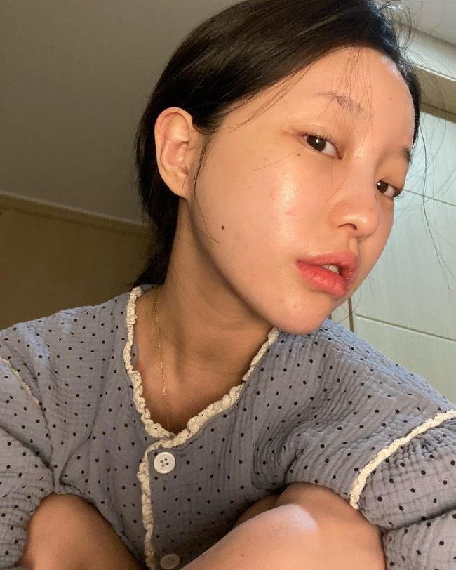 80% chị em quên làm 1 điều khi rửa mặt khiến da không đủ sạch sẽ, thông thoáng-1