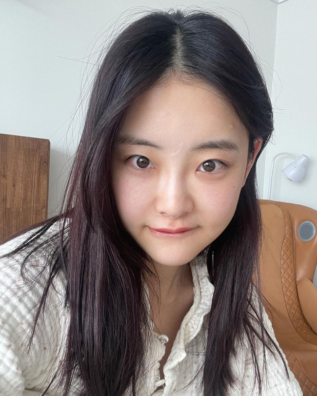 80% chị em quên làm 1 điều khi rửa mặt khiến da không đủ sạch sẽ, thông thoáng-2