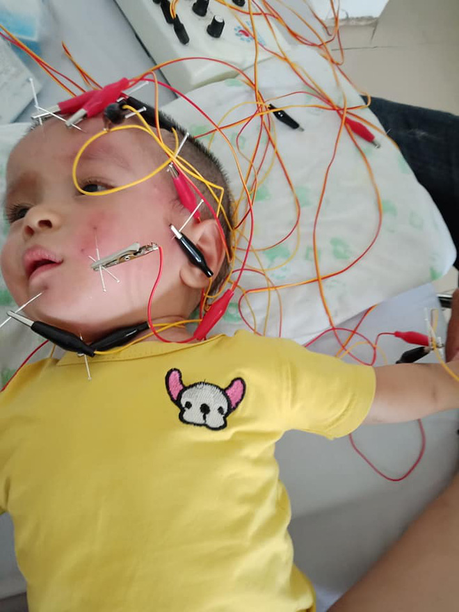 Mẹ của bé được bà Phương Hằng bay sang Singapore cứu trợ tiền mổ não: Cứ nhìn đôi mắt, miệng cười của con, em lại hồi tưởng đến đêm định mệnh ấy-3