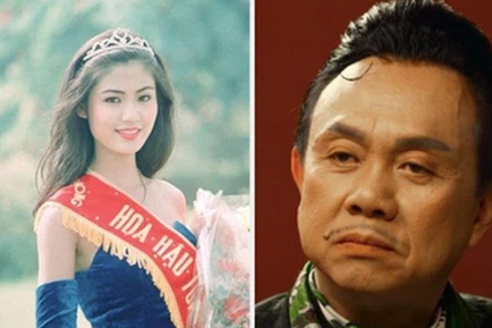 Hoa hậu Thu Thủy, cố nghệ sĩ Chí Tài đều qua đời vì đột quỵ: Cảnh báo 7 dấu hiệu trước khi cơn đột quỵ xảy ra, người trẻ cũng có thể mắc