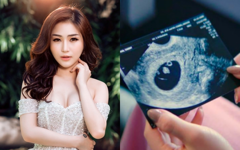 Sự thật về bức ảnh siêu âm thai nhi gây xôn xao của Hương Tràm-1