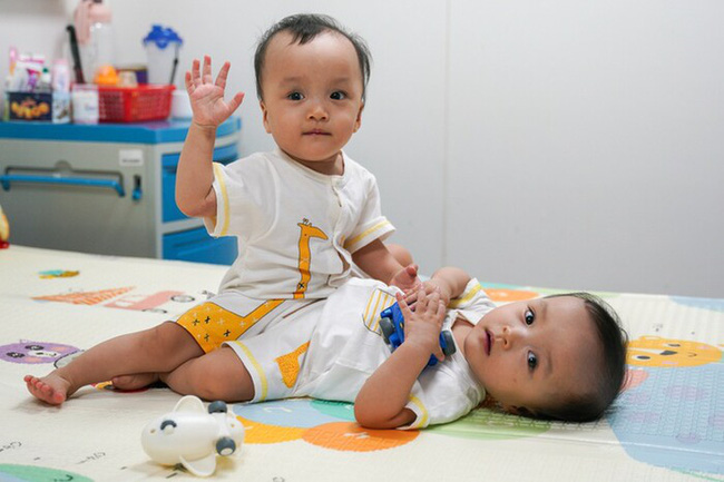 Bất ngờ với hình ảnh hiện tại của cặp song sinh tách rời Trúc Nhi - Diệu Nhi: Hôm nay chính thức tròn 2 tuổi, bạo dạn, hiếu động và lúc nào cũng vui tươi-1