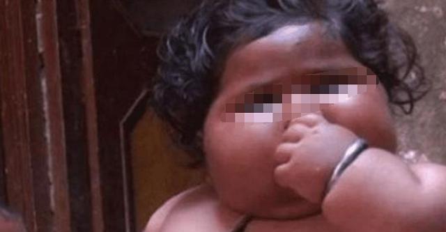 Cậu bé 1 tuổi nặng hơn 22kg, trung bình một ngày ăn 15 bữa, cuộc sống 6 năm sau khiến ai nấy giật mình-3