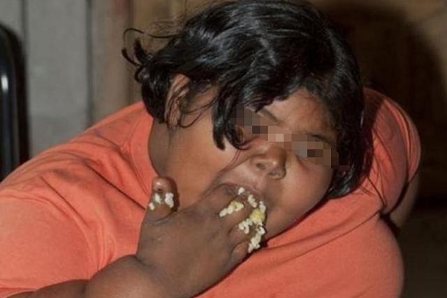 Cậu bé 1 tuổi nặng hơn 22kg, trung bình một ngày ăn 15 bữa, cuộc sống 6 năm sau khiến ai nấy giật mình-4