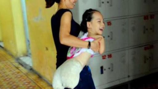 Bác sĩ chẩn đoán bào thai hải cẩu”, khuyên nên bỏ nhưng người mẹ kiên quyết sinh con, đứa trẻ sau này khiến ai cũng bất ngờ-2