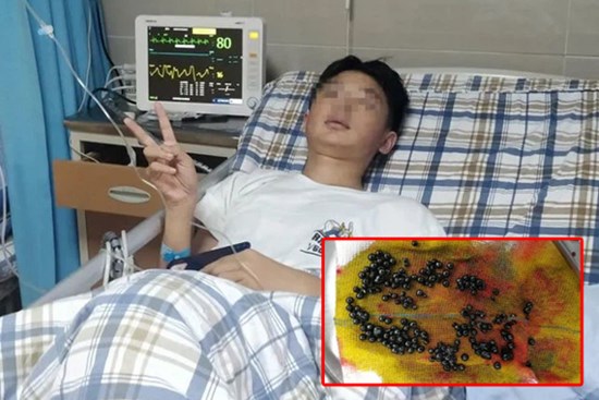 Chàng trai 15 tuổi có hàng trăm viên sỏi trong túi mật chỉ vì nghiện đồ chiên rán và nước ngọt