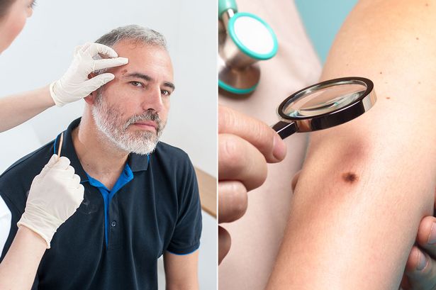 Đây là căn bệnh ung thư giết chết 2.500 người Anh mỗi năm, 6 dấu hiệu cảnh báo rất ít ai ngờ đến-1