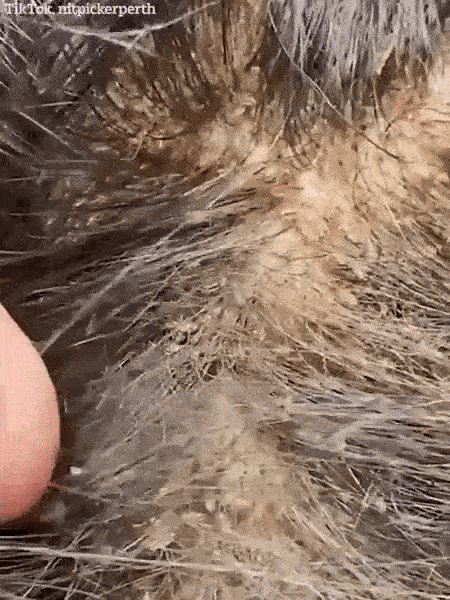 Mang mái tóc bẩn thỉu, lúc nhúc hàng ngàn con chấy đến phòng khám, cô gái khiến chuyên gia thảng thốt vì sốc và kết quả đáng kinh ngạc-2