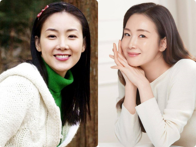 Người đẹp khóc Choi Ji Woo: Từng có giai đoạn mặt sưng phù cứng đơ vì tiêm Botox-3