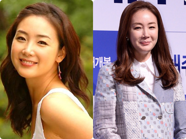 Người đẹp khóc Choi Ji Woo: Từng có giai đoạn mặt sưng phù cứng đơ vì tiêm Botox-6