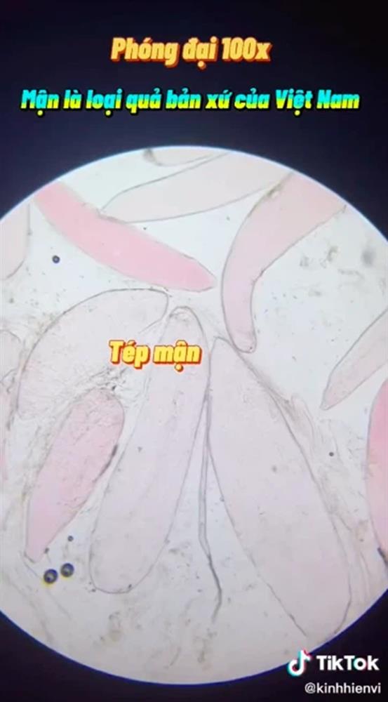 Kết quả bất ngờ khi soi quả mận dưới kính hiển vi và 5 đối tượng dù thèm cũng không nên ăn mận kẻo rước bệnh vào người-1