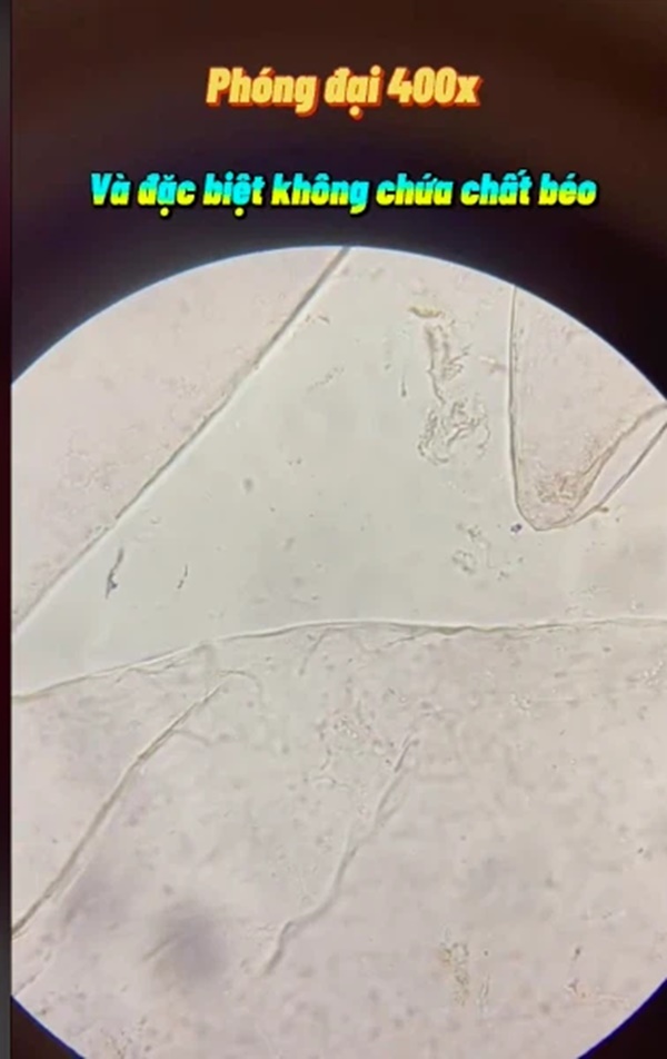 Kết quả bất ngờ khi soi quả mận dưới kính hiển vi và 5 đối tượng dù thèm cũng không nên ăn mận kẻo rước bệnh vào người-3