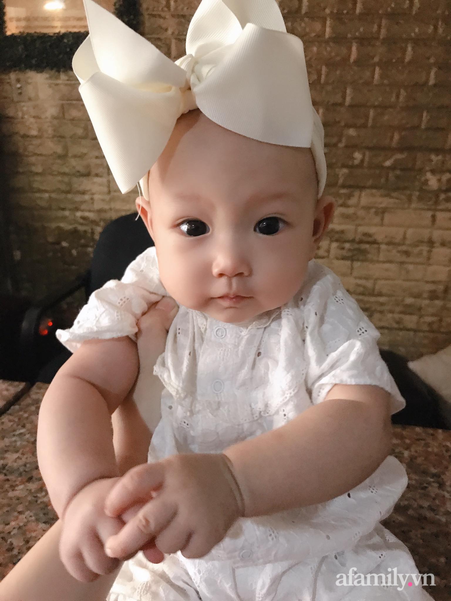 Đinh ninh ăn nhiều trứng vịt lộn khi mang thai sẽ đẻ con rậm tóc, mẹ trẻ bật ngửa khi thấy em bé ra đời-5