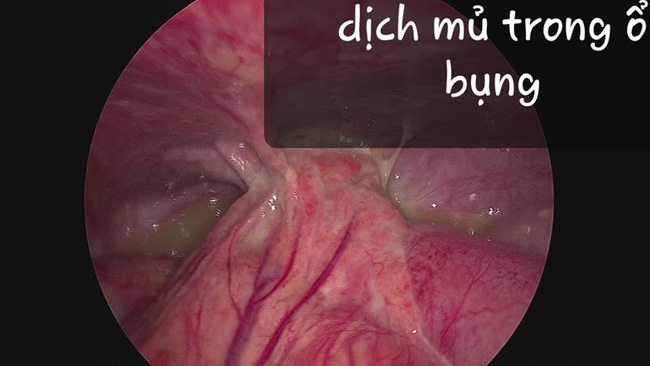 Bé gái 8 tuổi suýt tử vong vì gia đình sợ COVID nên không đưa con đi khám-1