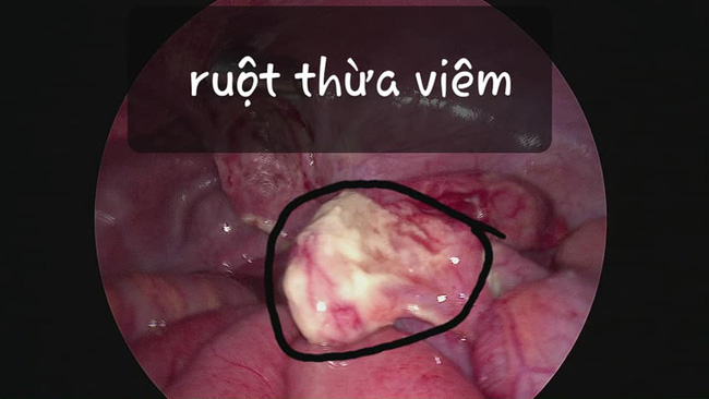 Bé gái 8 tuổi suýt tử vong vì gia đình sợ COVID nên không đưa con đi khám-2