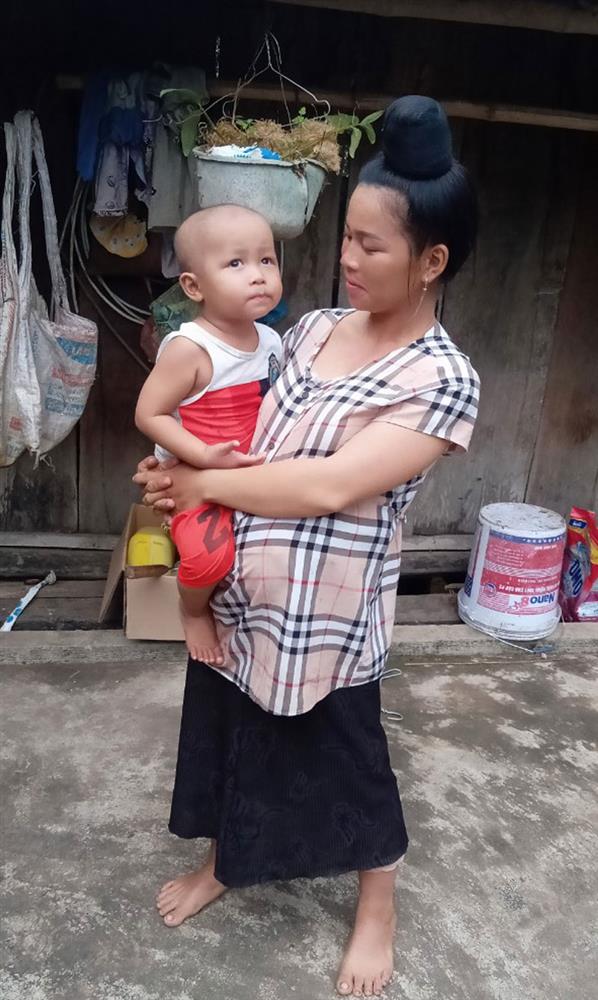 Bố cậu bé 3 tuổi mắc ung thư võng mạc vừa hết cách ly ở Viện K: những bữa cơm không thịt và ước mơ con sớm khỏi bệnh-3