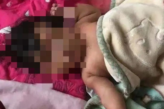 Bé sơ sinh bị anh trai 3 tuổi đè chết, người mẹ biến mất khỏi hiện trường, bác sĩ nghi ngờ về nguyên nhân gây tử vong