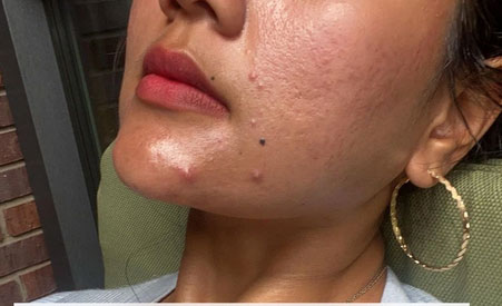 Nếu bạn cứ làm 4 bước skin care này thì lỗ chân lông trên da sẽ ngày càng to ngoác-1