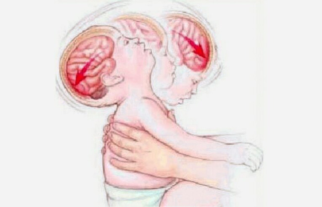 Được mẹ chồng chỉ cách dỗ con nín trong một nốt nhạc, bà mẹ gục ngã nghe thông báo con trai 8 tháng bị bại não-3