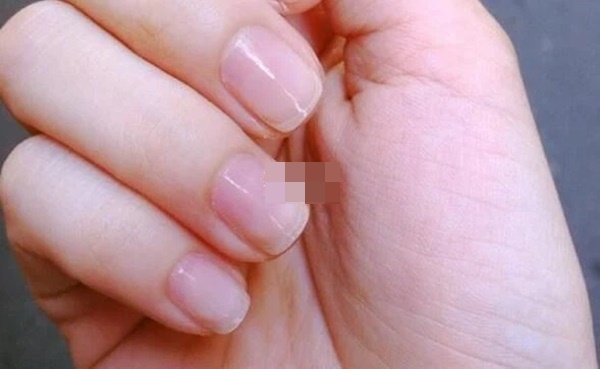 Người có mạch máu thông suốt, khỏe mạnh thường có chung 3 dấu hiệu nhỏ này ở ngón tay: Nếu có đủ, bạn có tiềm năng trường thọ rất cao!-2