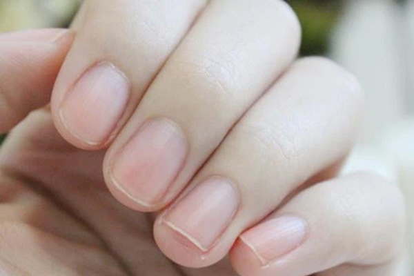 Người có mạch máu thông suốt, khỏe mạnh thường có chung 3 dấu hiệu nhỏ này ở ngón tay: Nếu có đủ, bạn có tiềm năng trường thọ rất cao!-3