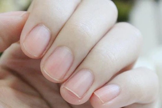 Người có mạch máu thông suốt, khỏe mạnh thường có chung 3 dấu hiệu nhỏ này ở ngón tay: Nếu có đủ, bạn có tiềm năng trường thọ rất cao!