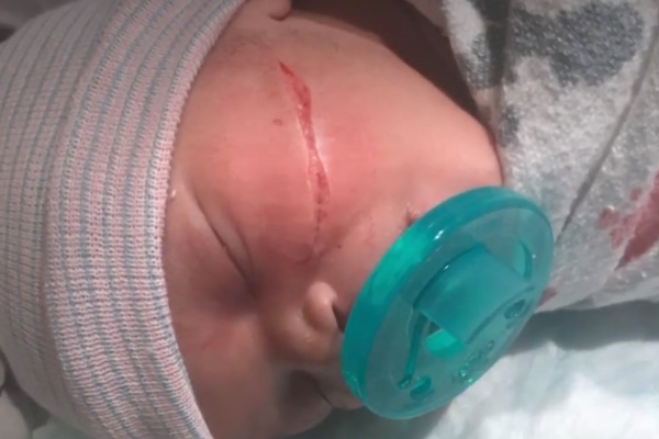 Nghe tiếng nổ lớn từ phòng ngủ, bà hoảng hồn phát hiện tay cháu gái bị nướng chín bởi thiết bị thông minh nhiều phụ huynh vẫn mua cho con-3