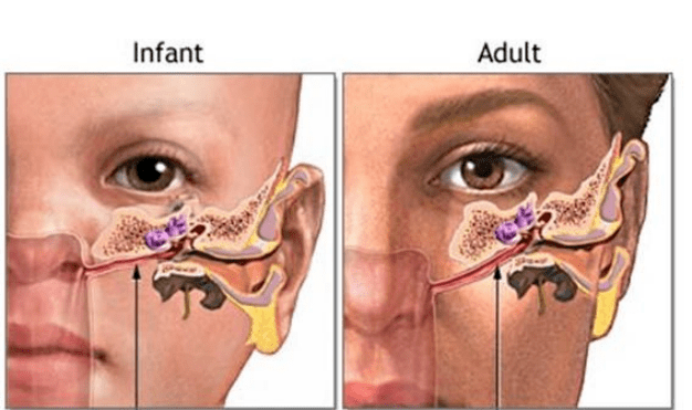 Mũi của trẻ sơ sinh bị tẹt, có thể trở nên cao và thẳng bằng cách vuốt lên không? Sự thật sẽ khiến nhiều người bất ngờ-2