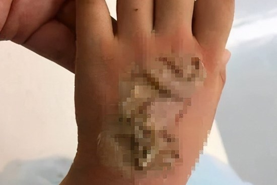 Nghe tiếng nổ lớn từ phòng ngủ, bà hoảng hồn phát hiện tay cháu gái bị 