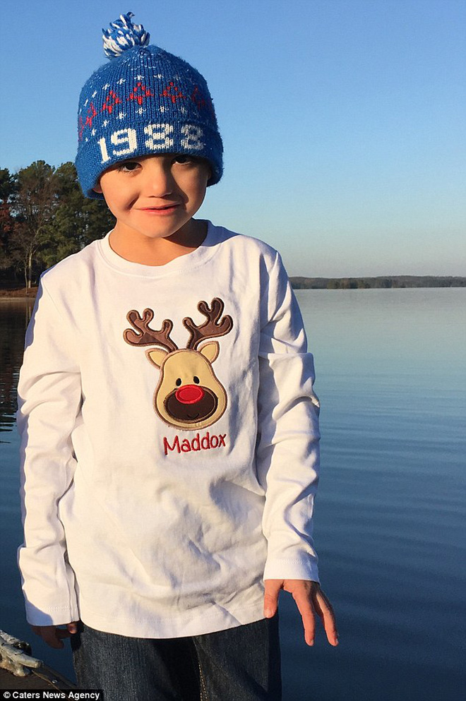 Vừa ra đời đã bị bác sĩ vô tình làm rơi, bé trai từng được chẩn đoán suốt đời không thể cười” gây xúc động với hình ảnh sau 12 năm-6